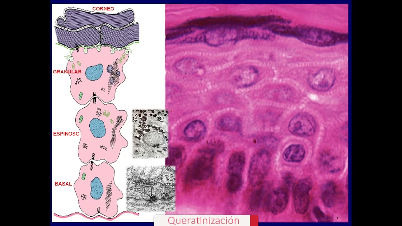 Queratinización