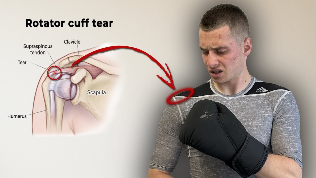 Fix Your Shoulder Pain from Boxing