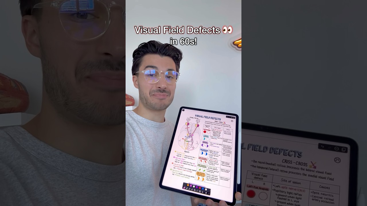 Простой способ исправить дефекты поля зрения 👀❌ #студентмедуниверситета #медицинскаяшкола ##usmle...