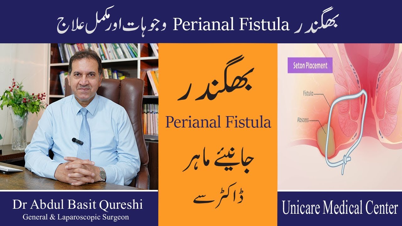 Perianal Fistula Causes Symptoms Treatment Urdu Hindi - Bhagandar Ka Ilaj- How To Treat Fistula