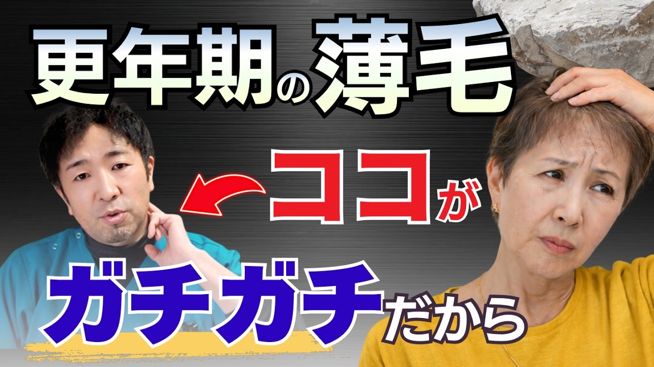 【40代50代】更年期後の薄毛はミノキシジルの前にこの対策をしましょう。ストレスが薄毛を引き起こす化学的メカニズム