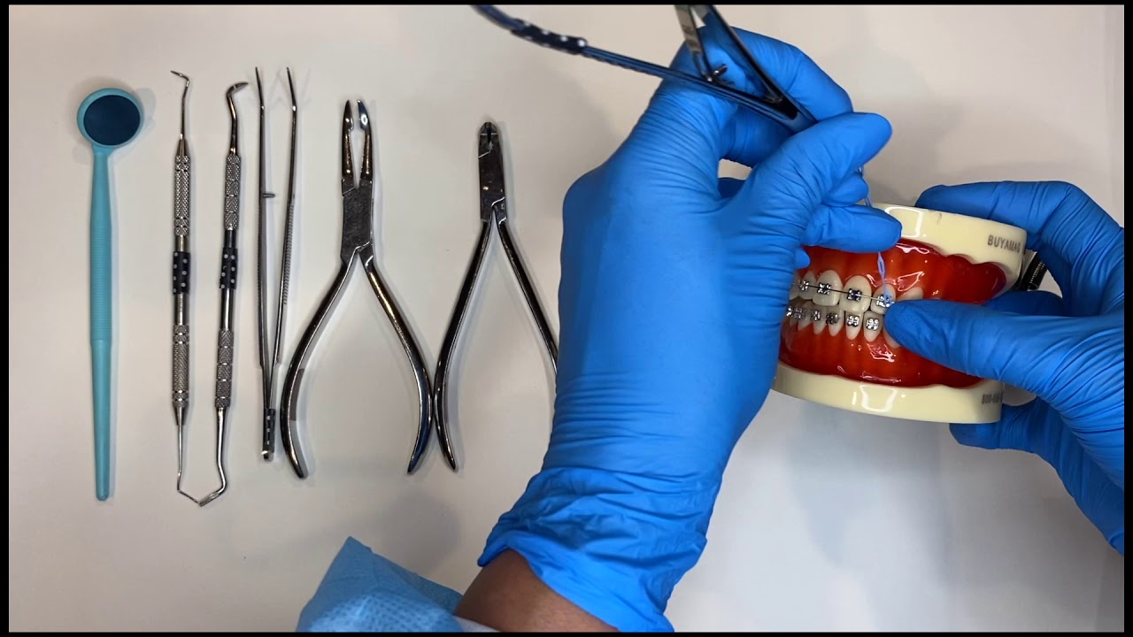 Placing and Removing Orthodontic Elastic Ties and Power Chain