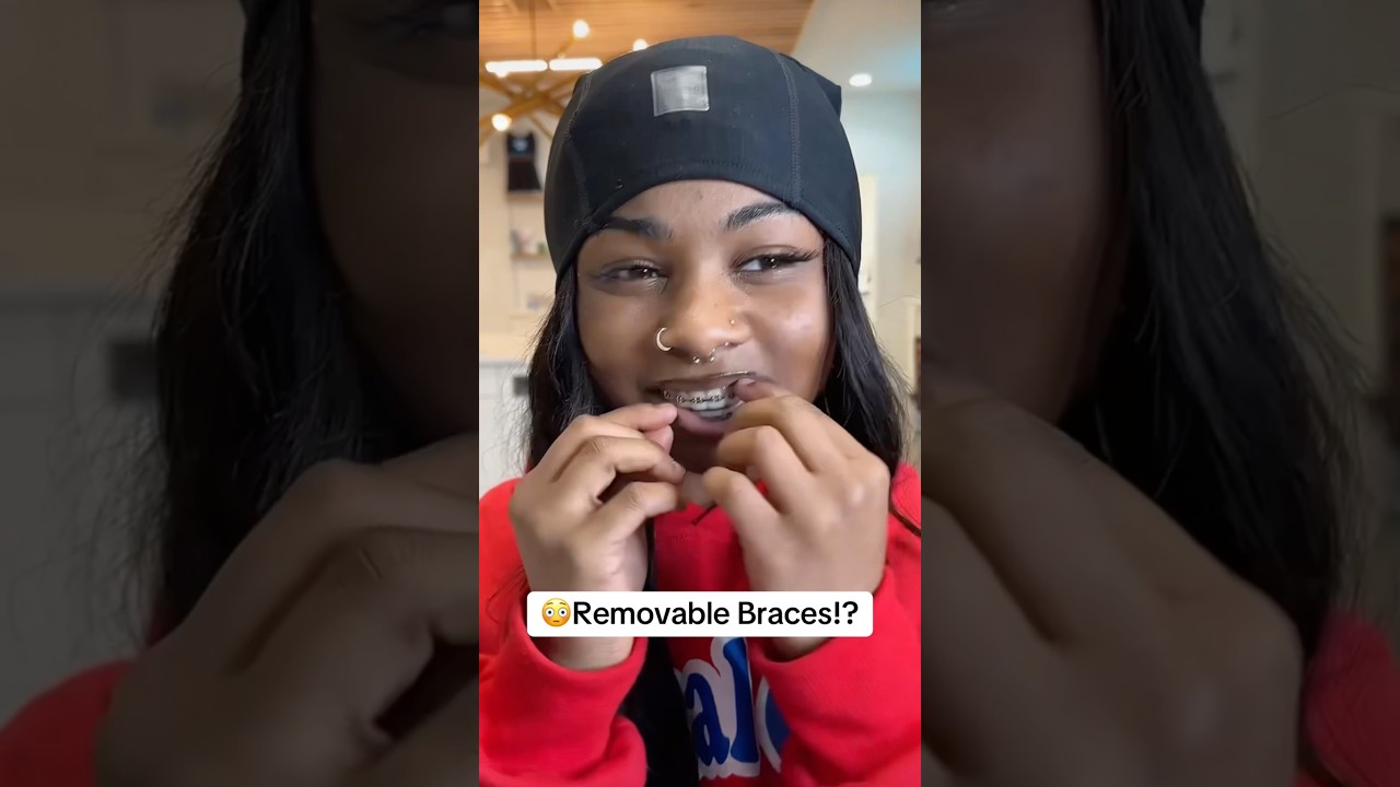 🥰Who else ❤️&rsquo;s their braces this much?  #braces #retainers #orthodontics #orthodontist #bracesoff