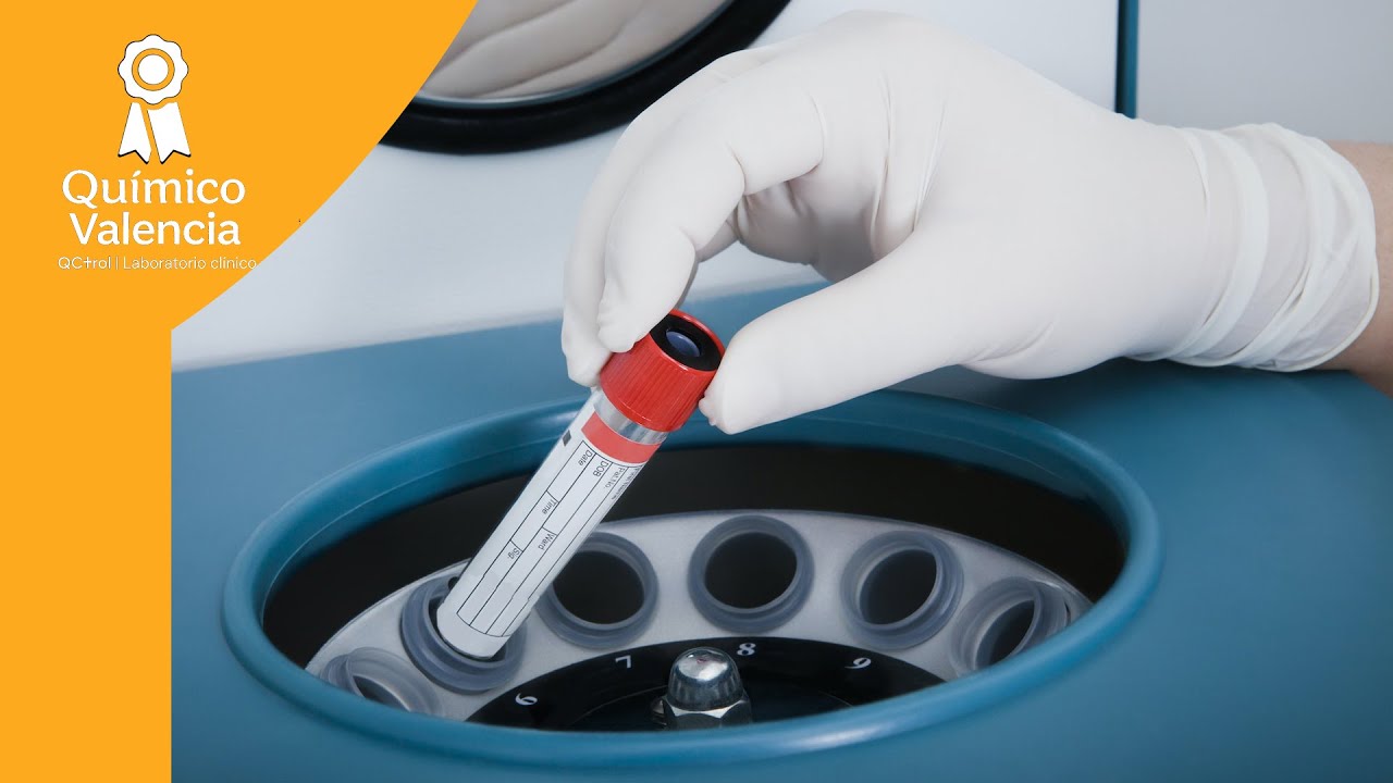 ЦЕНТРИФУГИРОВАНИЕ клинических лабораторных образцов