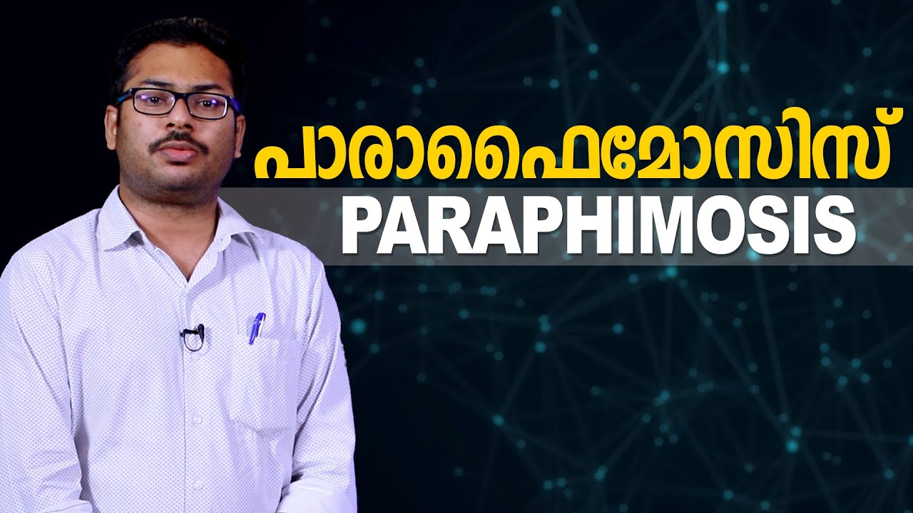 പാരാഫൈമോസിസ് | Paraphimosis || Dr. Promodu&rsquo;s Institute