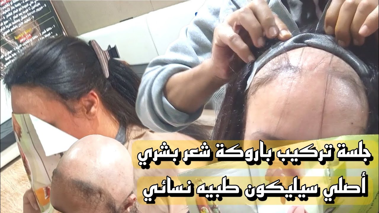 جلسة تركيب باروكة شعر بشري أصلي سيليكون طبية نسائي
