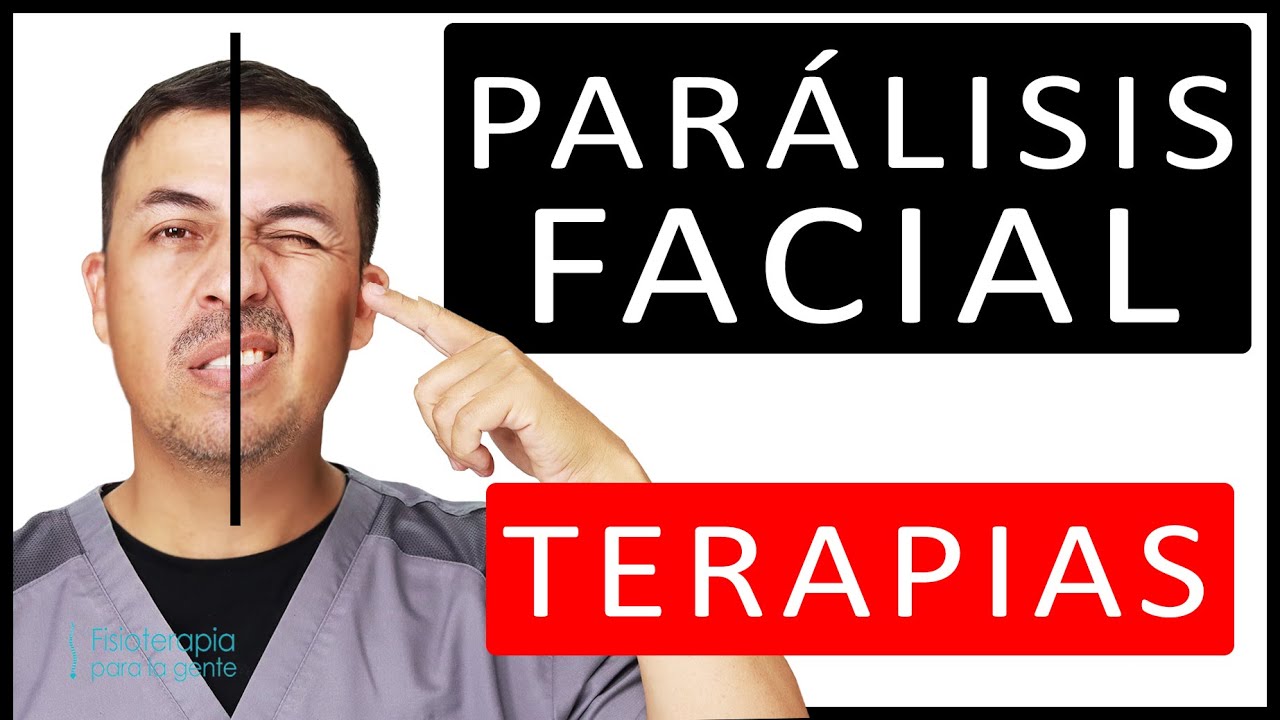 Paralisis facial 🧡 Todo lo que debes hacer para recuperarte 🤍