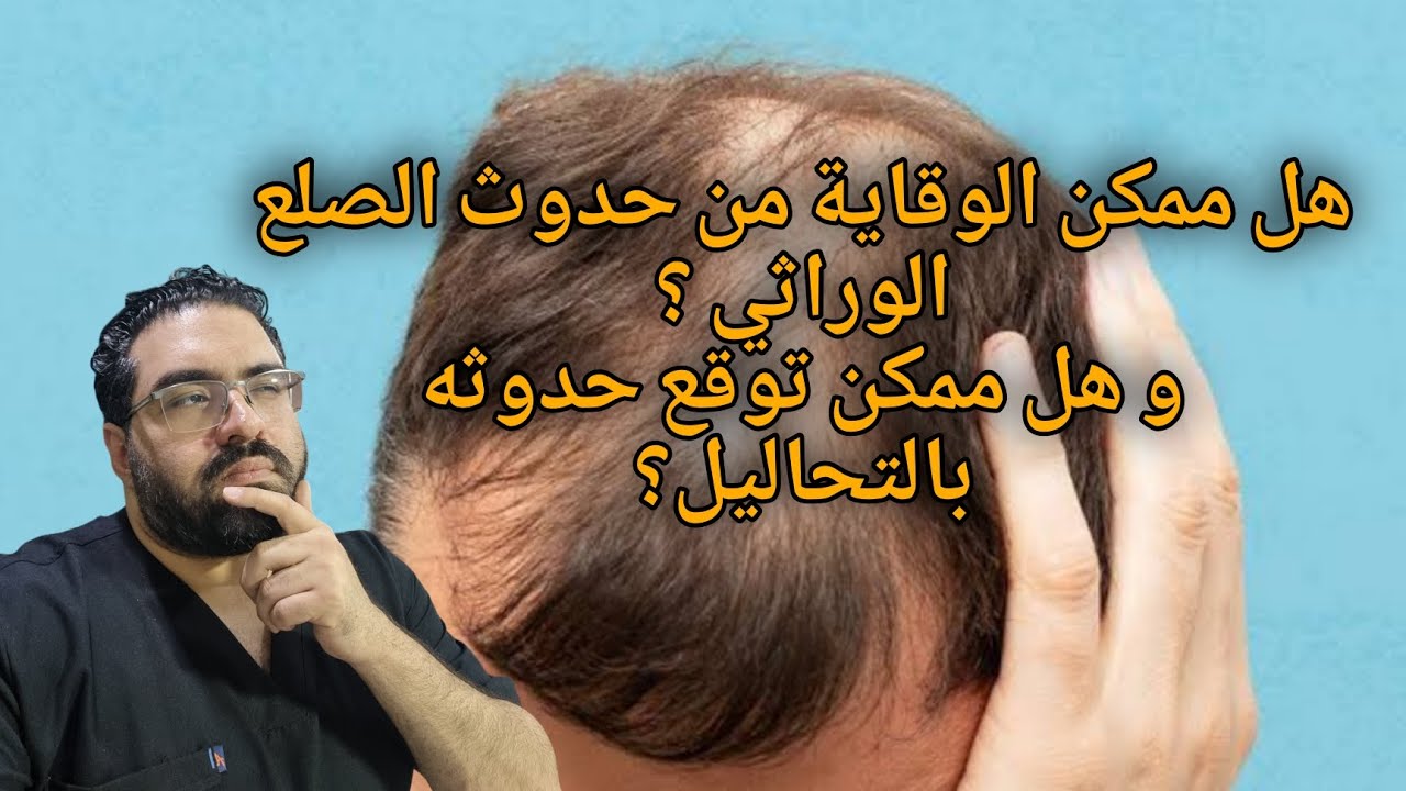 عيادة الجلدية - حلقة ٢٤ - هل ممكن الوقاية الصلع الوراثي؟ أو توقع حدوثه بالتحاليل؟