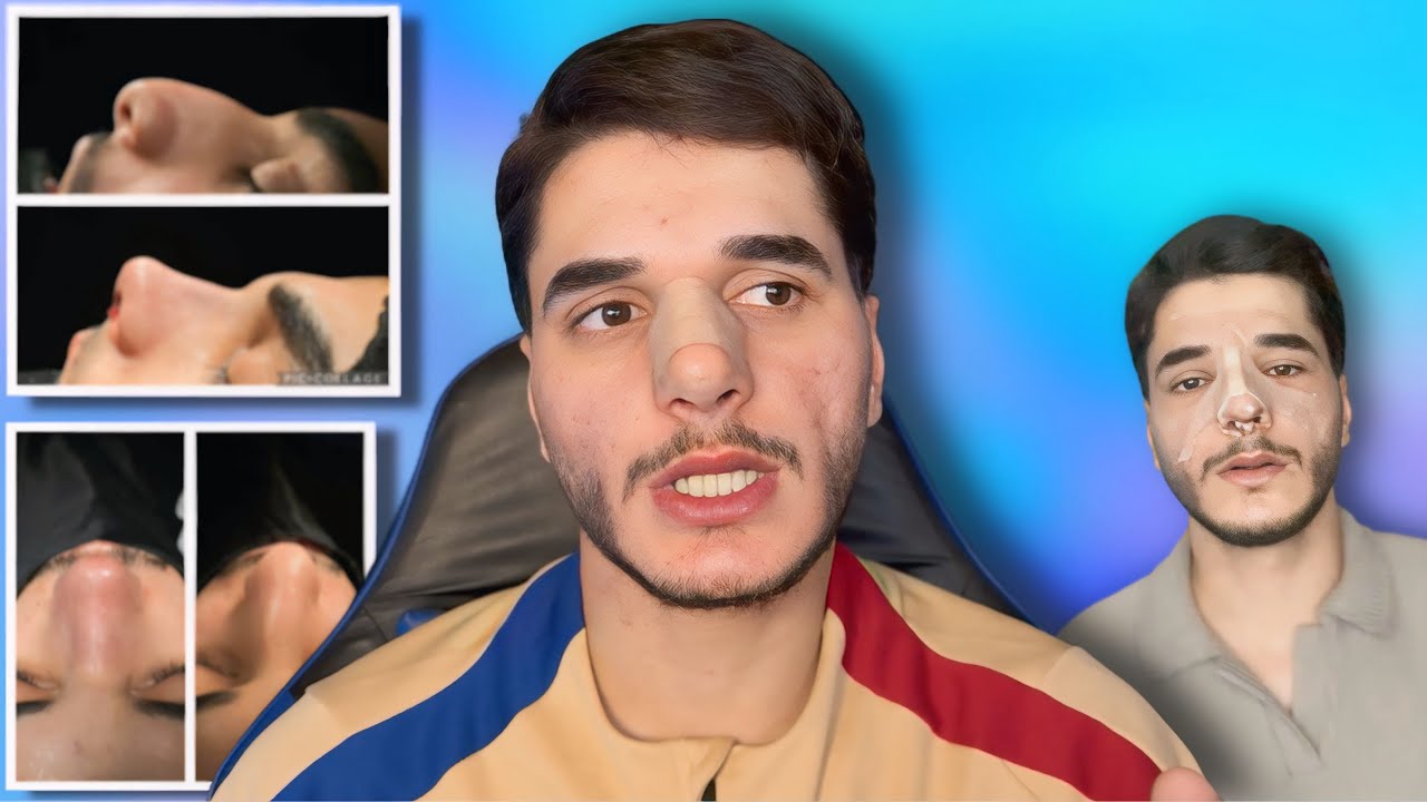 چیرووک | چەوا هزرا عەمەلیاتا دفنێ بومن هات ✅❤️‍🔥