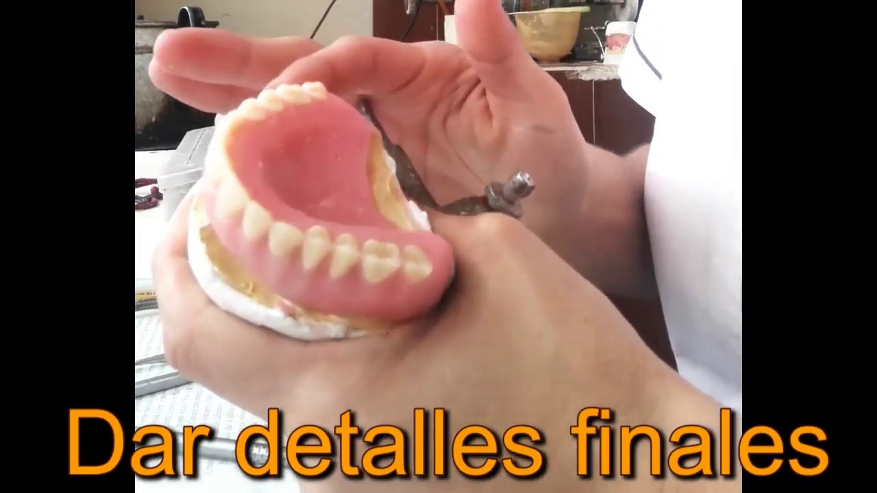 ENCERADO DE PRÓTESIS TOTALES / TIPS