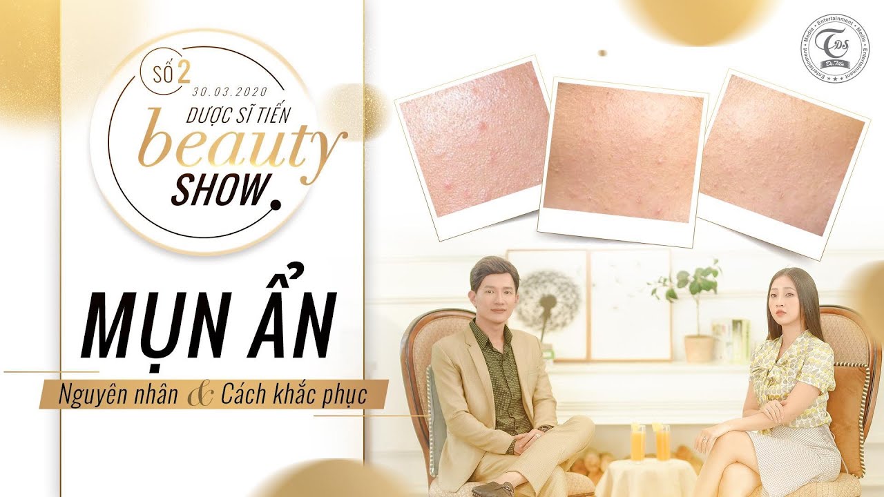 MỤN ẨN - Nguyên nhân & cách khắc phục | Dược sĩ Tiến Beauty Show | Vietsub