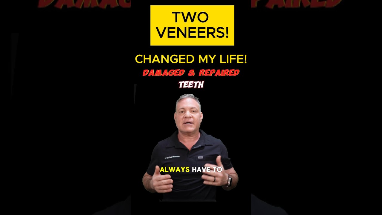 How 2 Veneers Transformed My Smile!