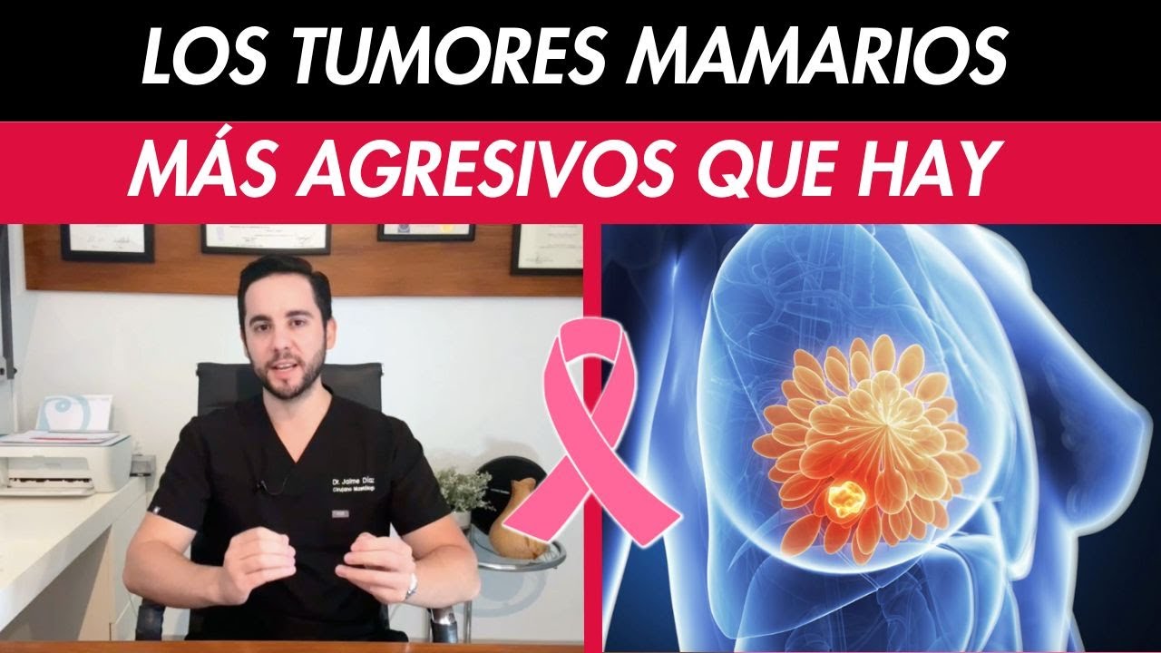 Tumores de mama m&aacute;s AGRESIVOS - C&Aacute;NCER DE MAMA Triple negativo - Her 2 neu