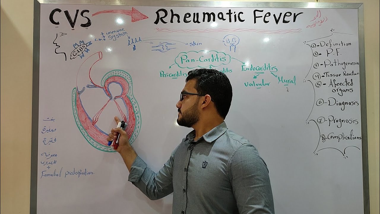 CVS module - Rheumatic fever part 1