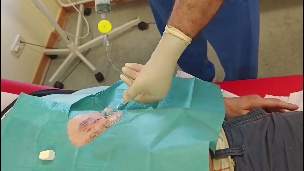 Multimodal Preop Optimization of  Loss-of-Domain Incisional Hernia Using Botulinum Toxin A and PPP