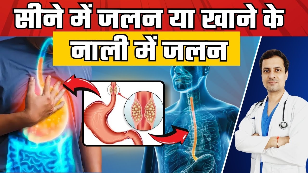 Understand heartburn or burning sensation in the food pipe. Heart Burn Foods To Avoid. Heart Burn in Hindi.