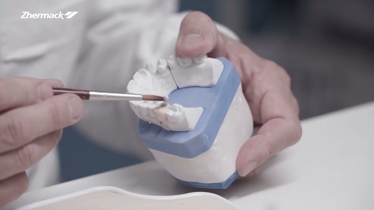 Dental Lab Procedure for Single Unit Crown - Chapter 6: Ceramic layering