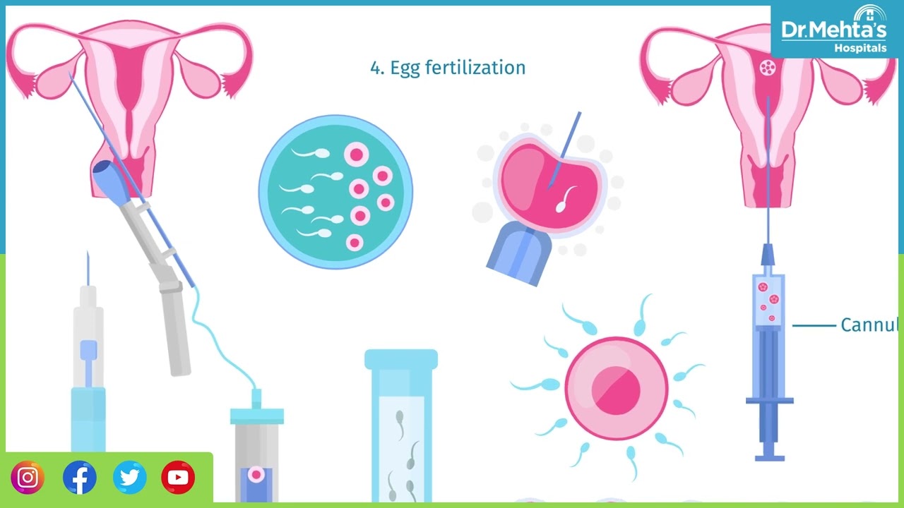 Difference Between Normal Fertilizations and IVF | Dr.Nancy Anitha | Dr.Mehtas Hospitals