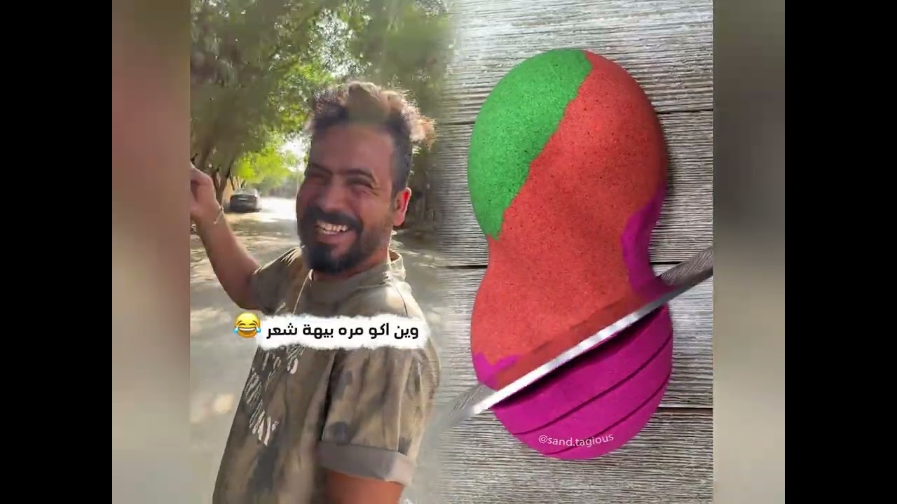 #الطفل الاعمى المعجزه #محضوره_من_الاكسبلور_والمشاهدات #علاوي_مارتن #اكسبلور 15_w