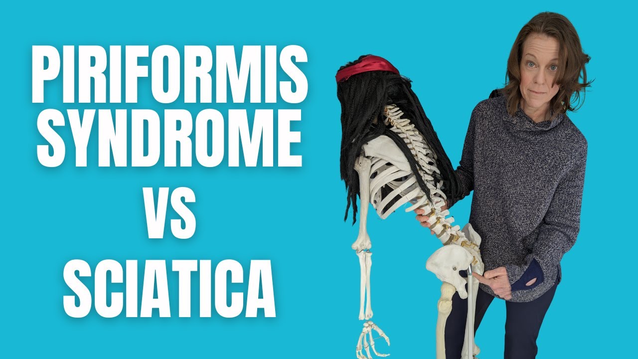 Discover the Difference Between Piriformis Syndrome & Sciatica!