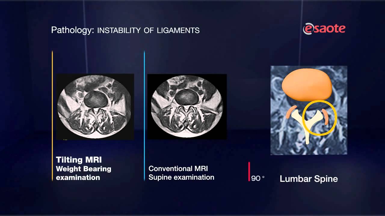 ESAOTE Tilting MRI - Add weight to your diagnosis with G-scan!