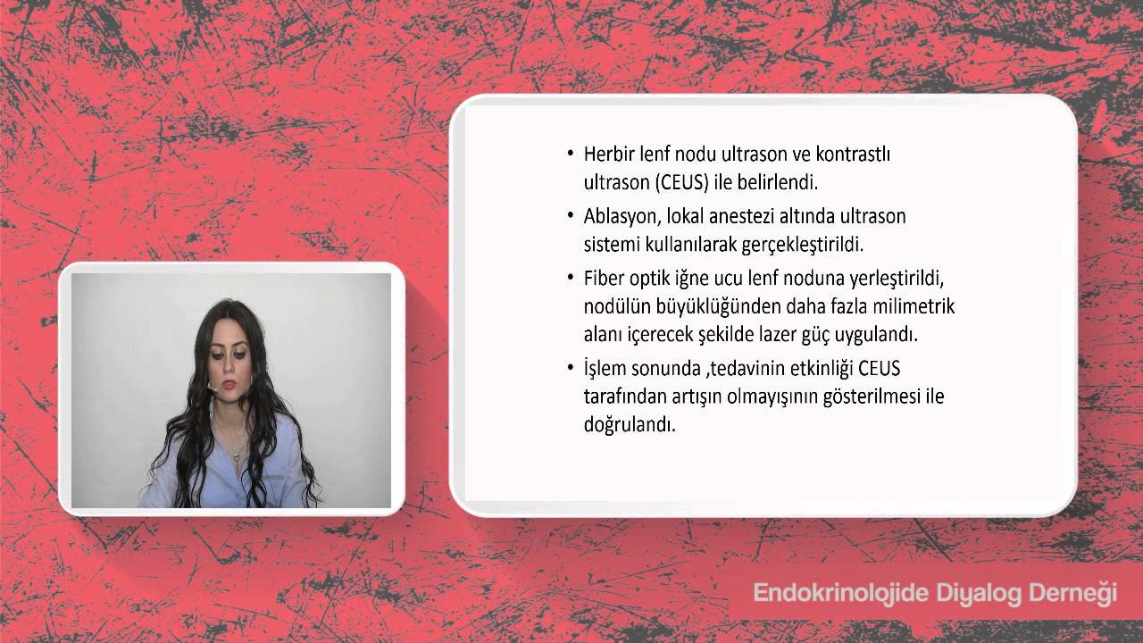 PERKÜTAN LAZER ABLASYON PAPİLLER TİROİD  KANSERLERİNİN SERVİKAL LENF NODU NÜKSLERİNDE  ETKİN TEDAVİ