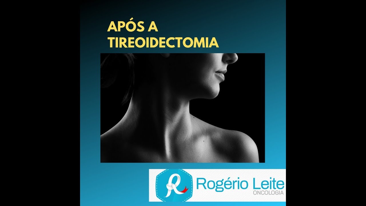 Orientações pós tireoidectomia-[060]- Dr. Rogério Leite