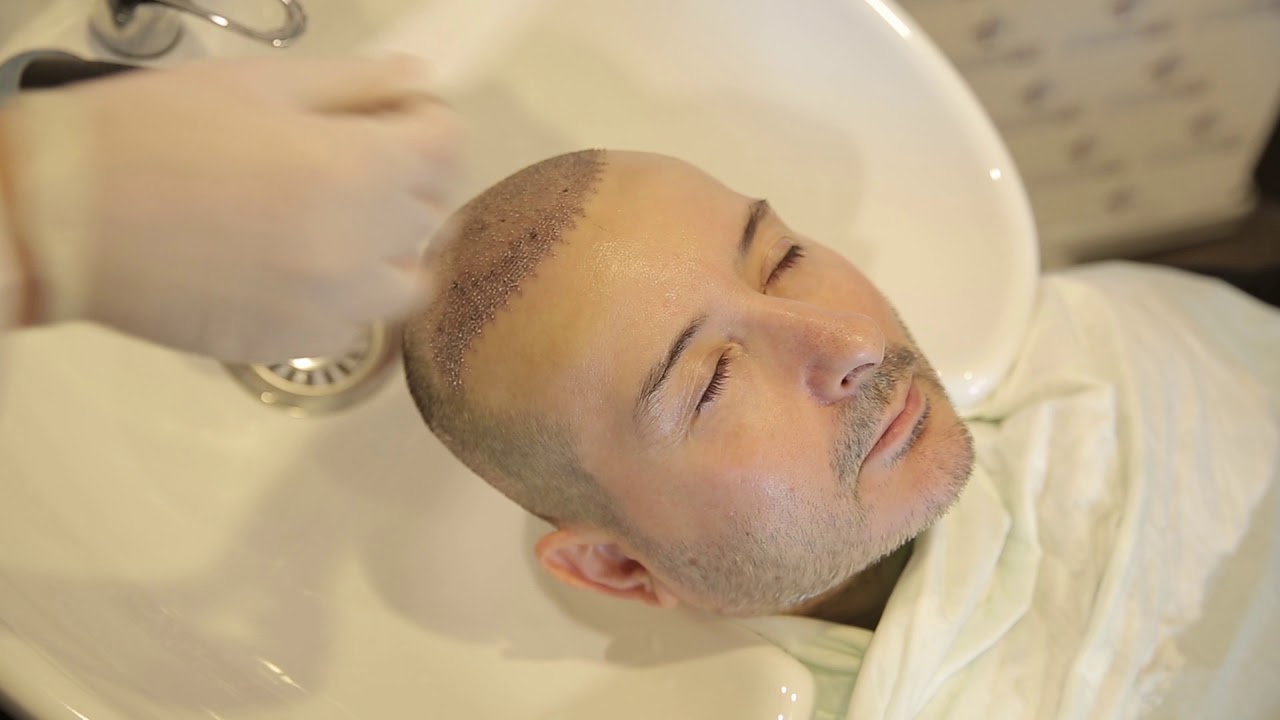 Lavaggio dei capelli per i 10 giorni di cura