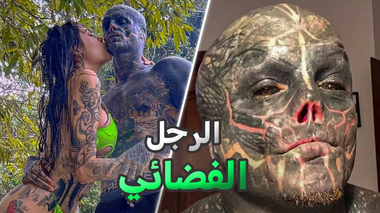 أغرب عملية تجميل في العالم 
