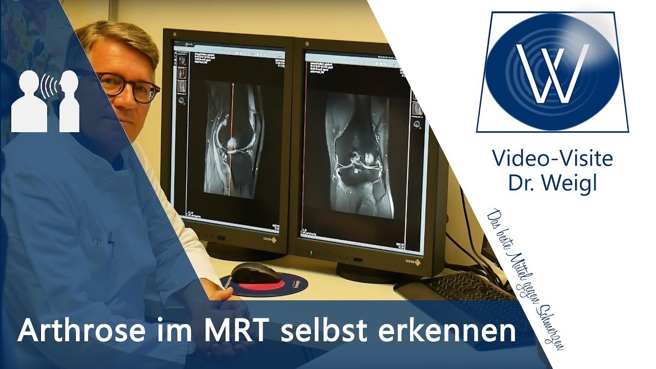 Knieschmerzen, Knieverletzung & Kniearthrose im MRT - Diagnose Arthrose, Kreuzbandriss, Meniskus