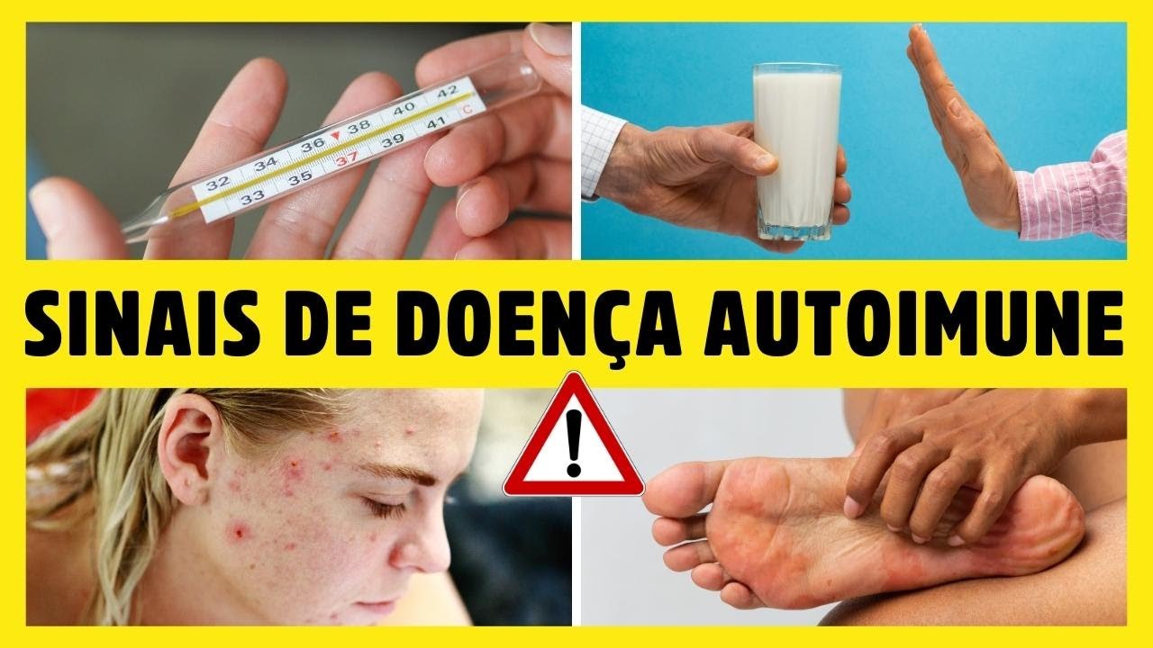 DOENÇA AUTOIMUNE: OS PRIMEIROS SINAIS E SINTOMAS SILENCIOSOS E PREOCUPANTES - Dr Alain Dutra