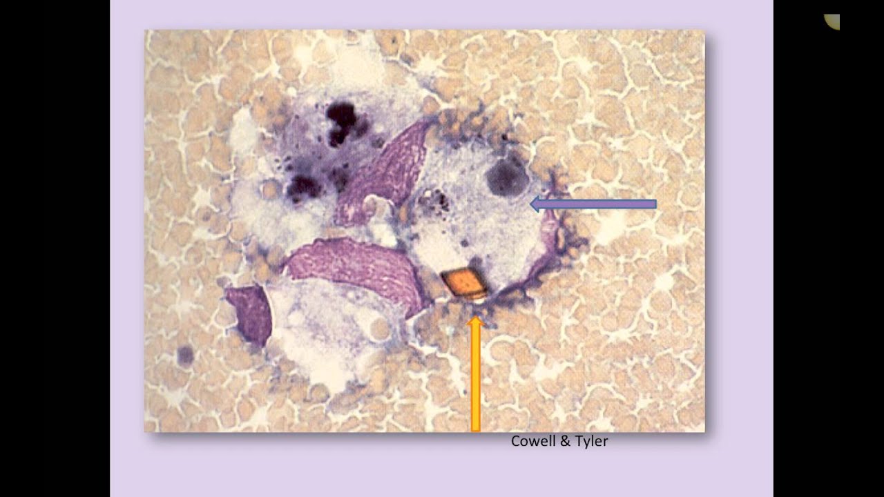 Classification of Cytology and Inflammation (Veterinary Technician Education)
