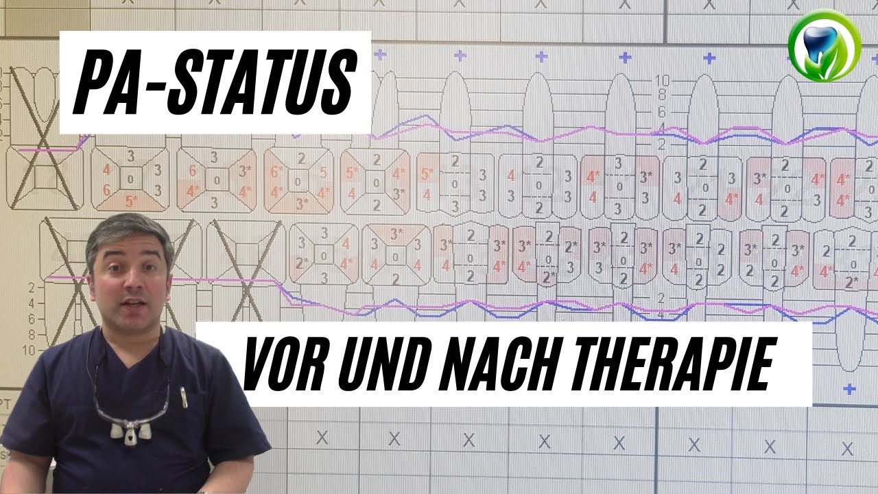 PA Status / Taschenmessung vor der Parodontitis Therapie und danach - Parodontose