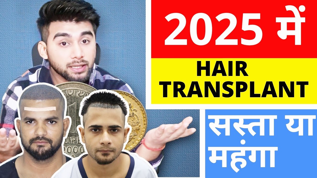 My Hair Transplant Cost From Surgery To Result 🔥🔥🔥 Hair Transplant Cost In India