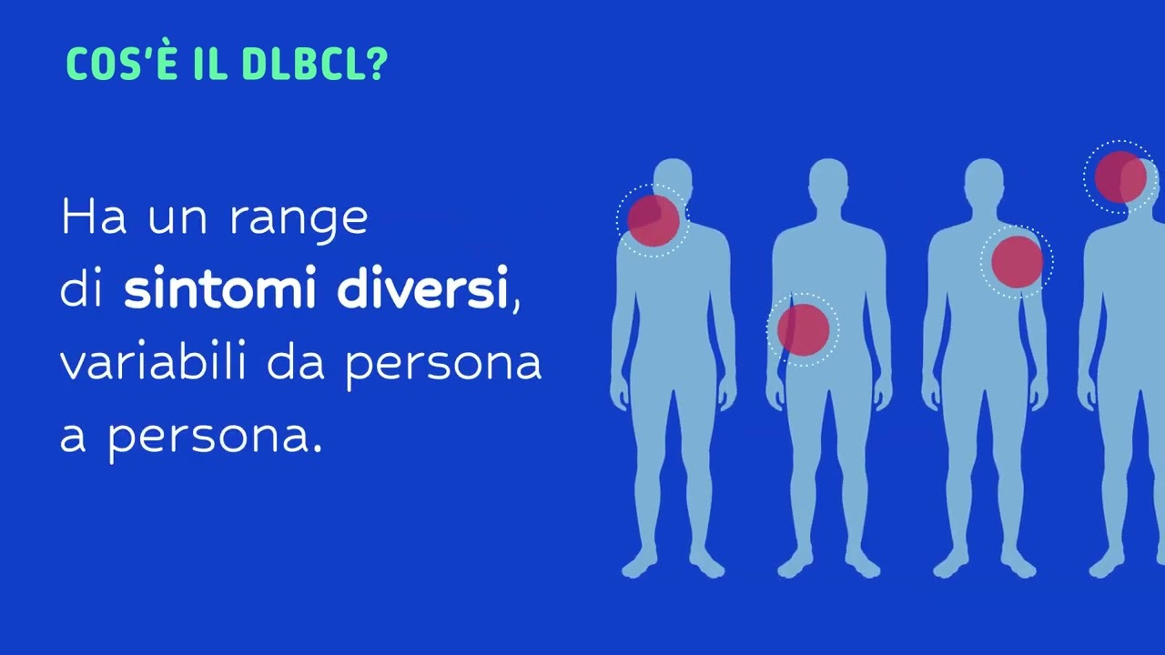 Cos'è il linfoma non Hodgkin