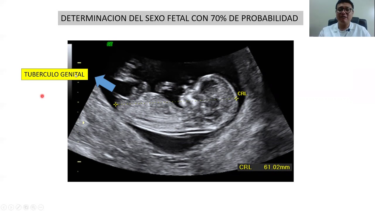 ECOGRAFIA GENETICA 2020