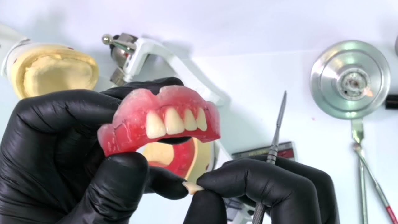 Vídeo 31 - Montagem dos dentes artificiais da bateria labial superior
