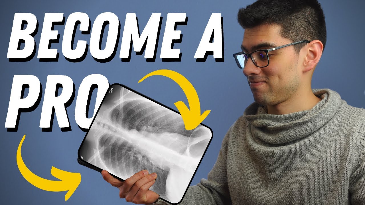 Tips to Learn Radiology in Medical School
