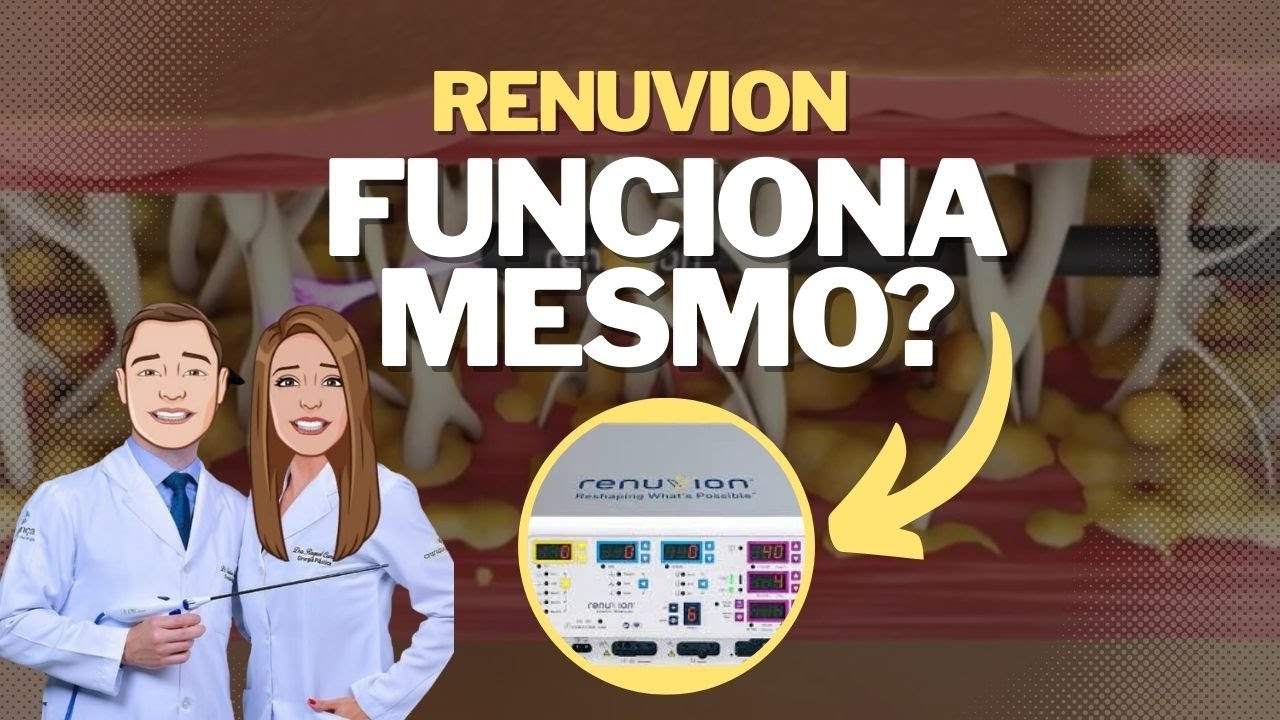 RENUVION PARA FLACIDEZ FUNCIONA? │Dr. Cristian Haesbaert e Dra. Raquel Camelo