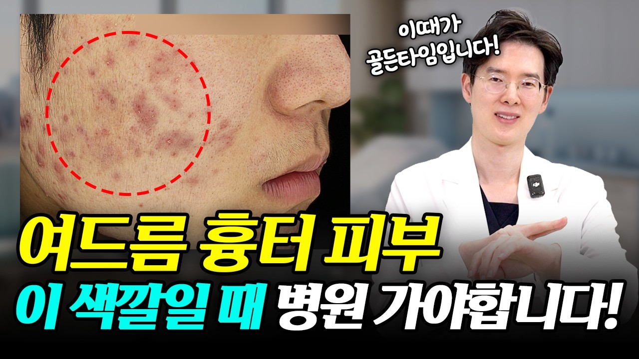 “여드름 흉터, 이 시기를 놓치면 치료비 2~3배 더 듭니다”ㅣ부산피부왕이 알려주는 여드름 흉터 치료의 골든타임!