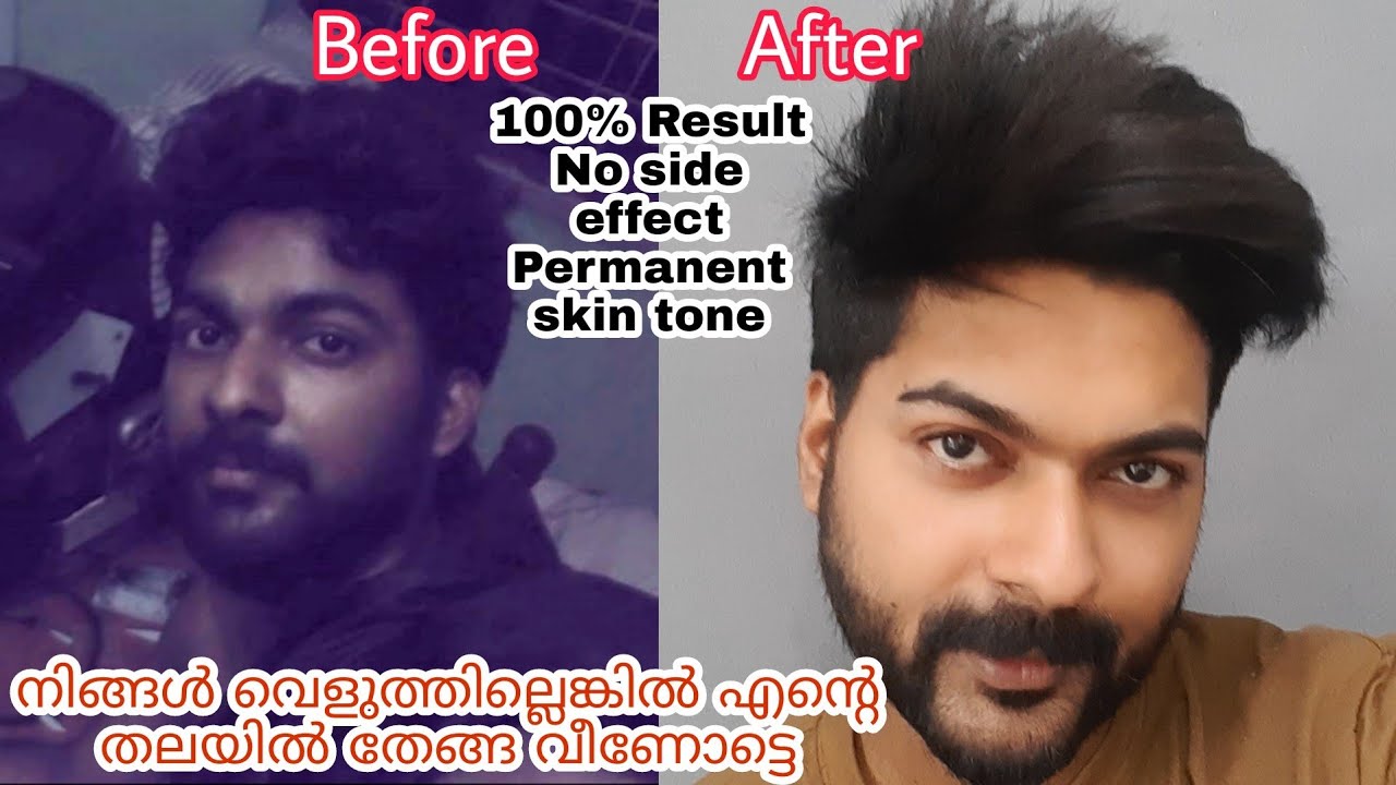 Real Skin whitening Secret 100% working | this is skin science