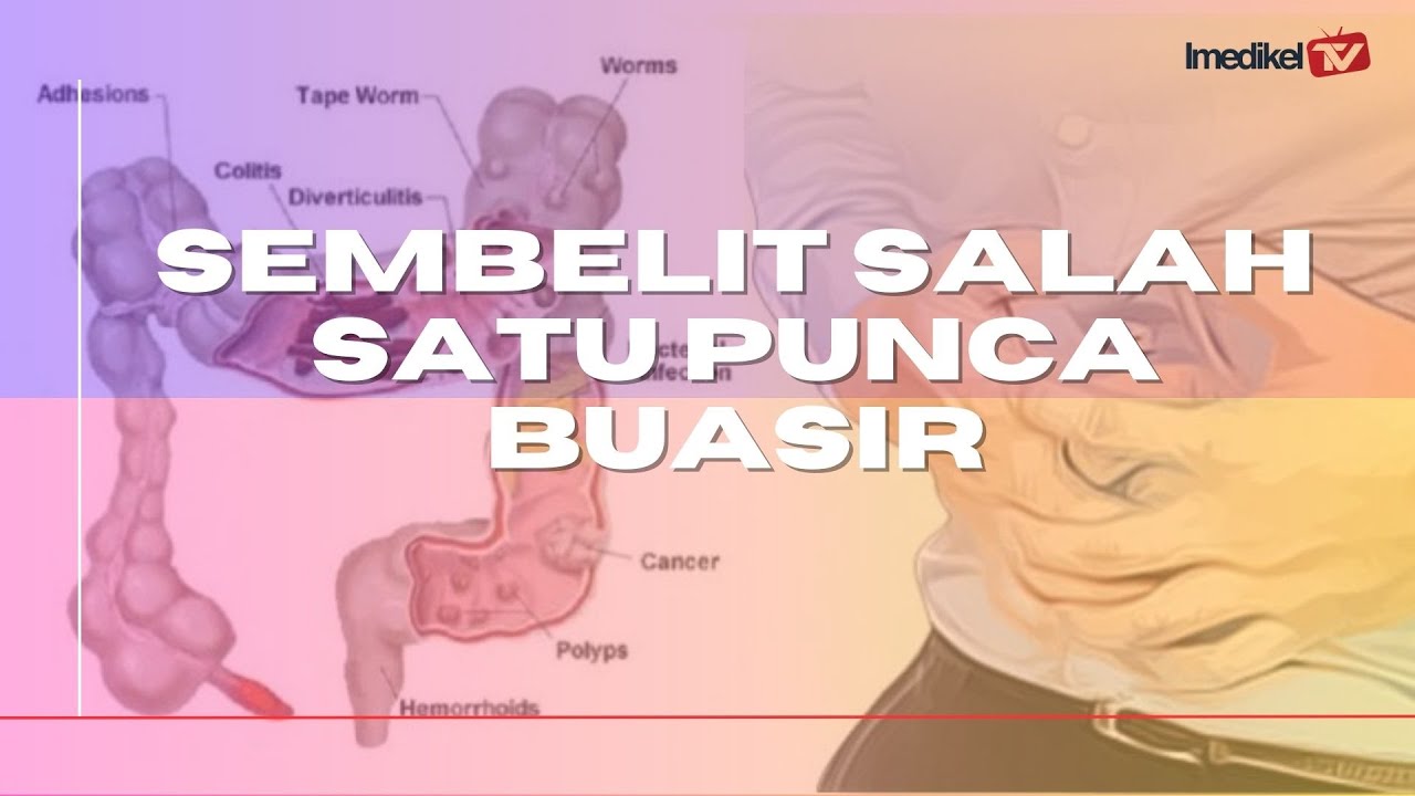 SEMBELIT SALAH SATU PUNCA BUASIR | Imedikel TV