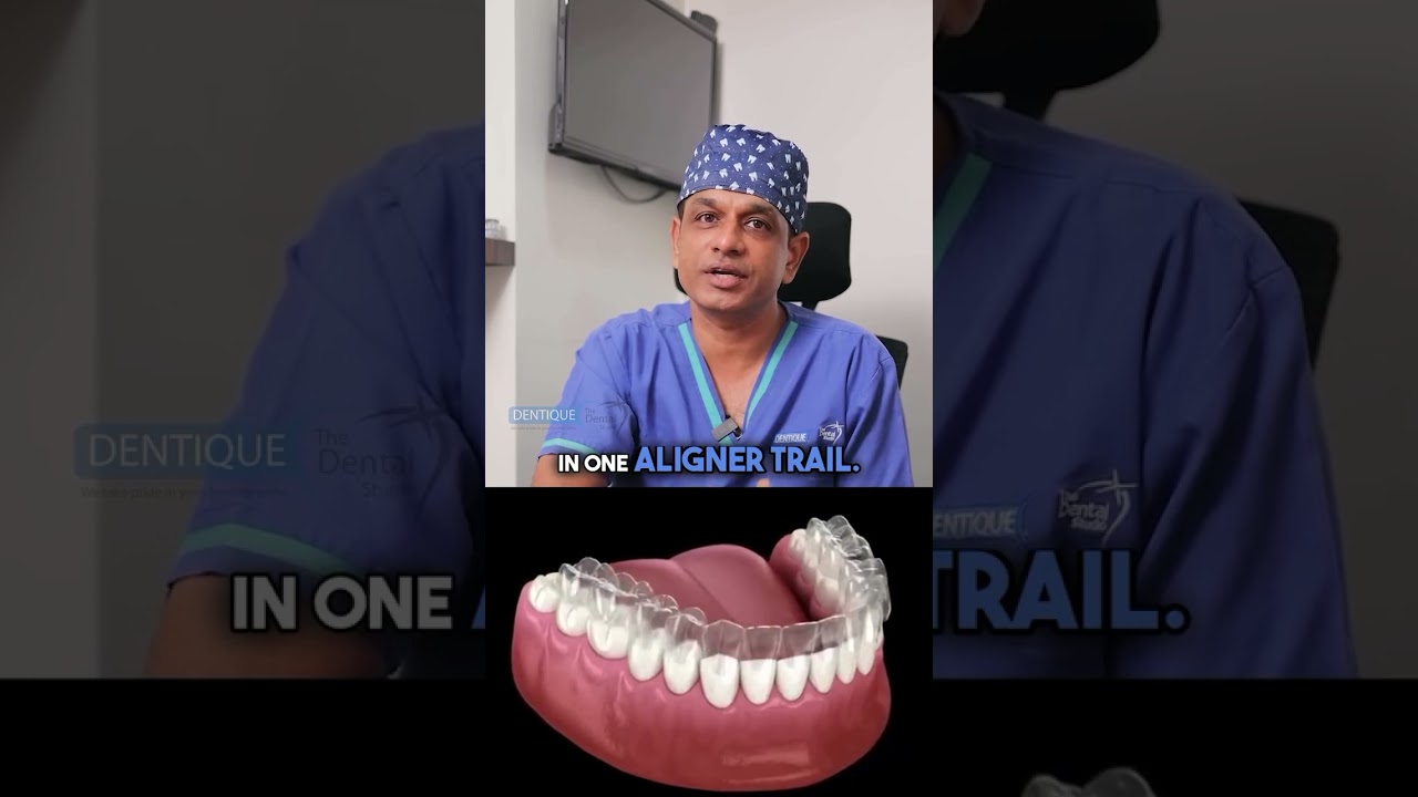 Faster Smile Progress with Clear Aligners | Teeth Aligners | Clear Aligner in Kerala