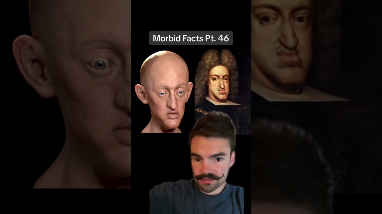 King Charles II: a HORRIFIC example of inbreeding #morbid
