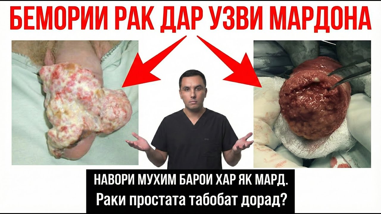 Бемории саратон чист? Сабабхо ва табобати раки простата/ подкаст бо Сафаров Зухал ва Махмадшоев