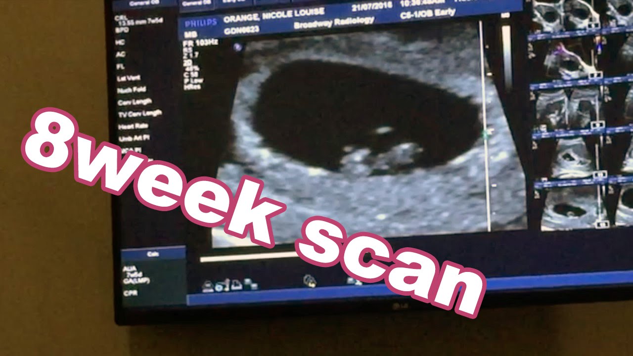 8 Week scan | 7w6d ultrasound of our wee baby