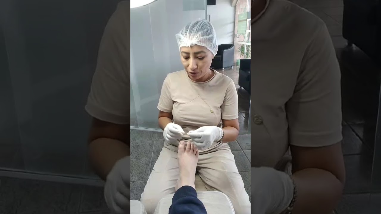 Resina dentaria para órtese e reconstrução ungueal!