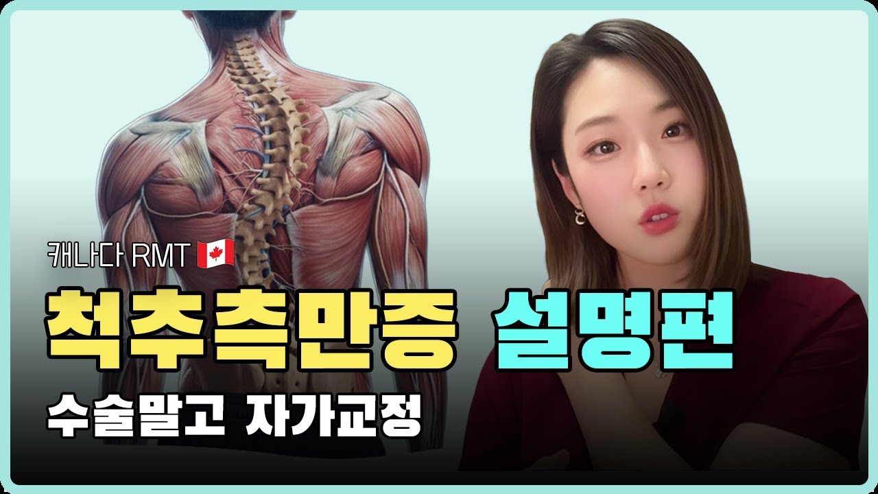척추측만증 교정? 짧아진 vs 약해진 근육, 자가체크와 보존치료_척추측만증 설명편