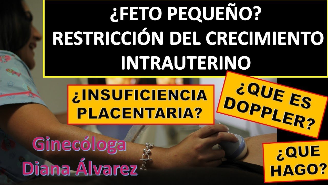 PROBLEMAS DE CRECIMIENTO FETAL, POR GINECOLOGA DIANA ALVAREZ