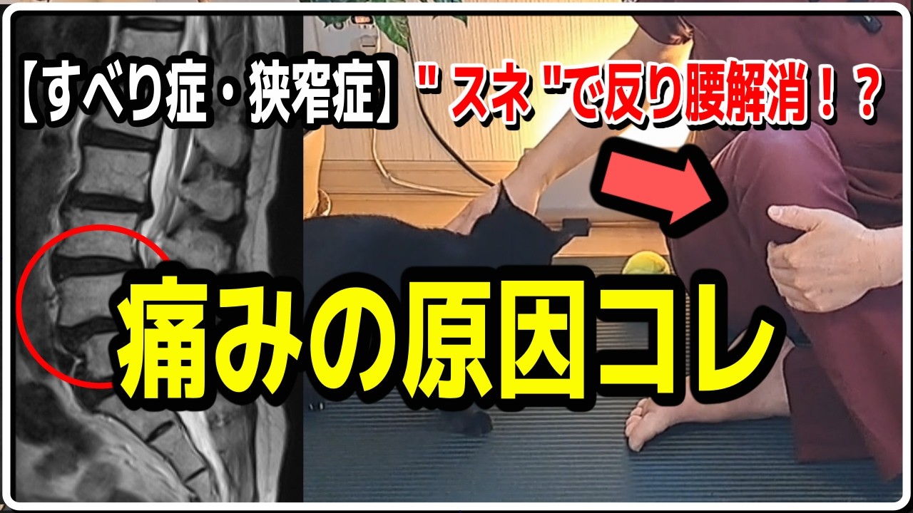 【すべり症・狭窄症】反り腰の原因になる「スネの外側」セルフケア